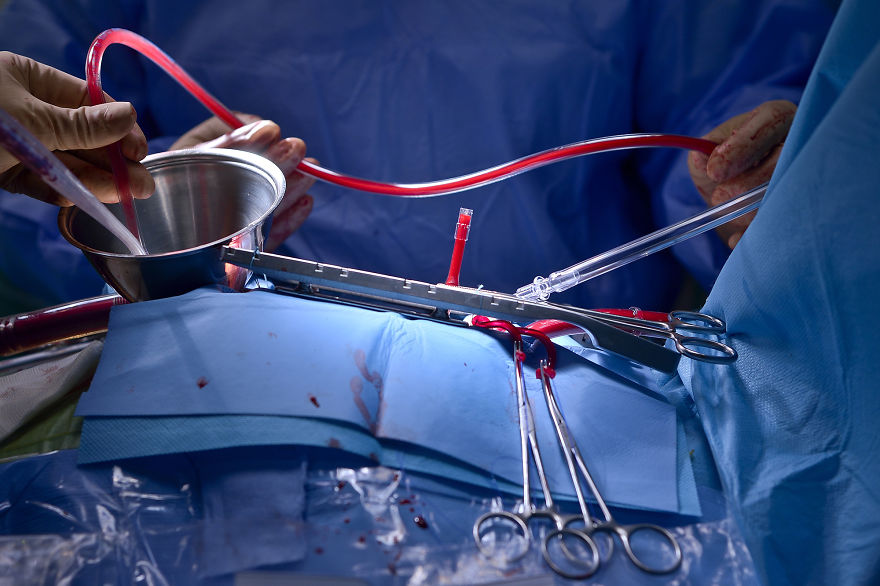 Gentle Violence: A Visual Exploration Of The Body During Open Heart Surgeries Gentle Violence: A Visual Exploration Of The Body During Open Heart Surgeries