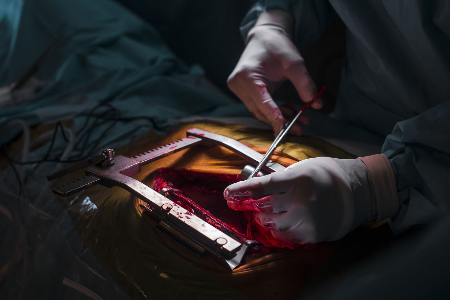 Gentle Violence: A Visual Exploration Of The Body During Open Heart Surgeries Gentle Violence: A Visual Exploration Of The Body During Open Heart Surgeries