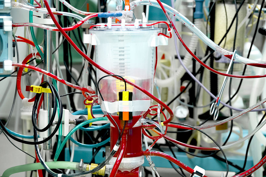 Gentle Violence: A Visual Exploration Of The Body During Open Heart Surgeries Gentle Violence: A Visual Exploration Of The Body During Open Heart Surgeries