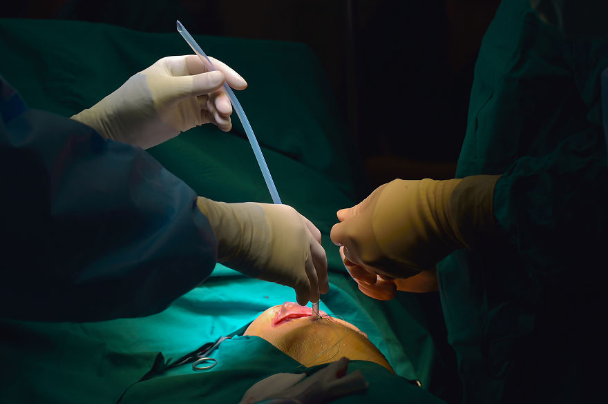 Gentle Violence: A Visual Exploration Of The Body During Open Heart Surgeries Gentle Violence: A Visual Exploration Of The Body During Open Heart Surgeries