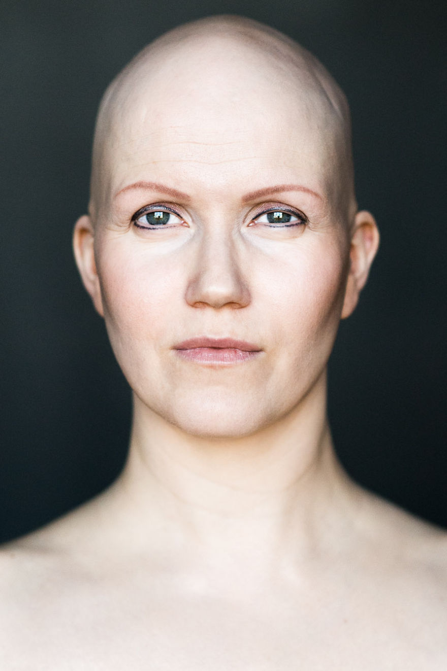 Baldvin: I Photograph Women With Alopecia To Break Gender Stereotypes Baldvin: I Photograph Women With Alopecia To Break Gender Stereotypes