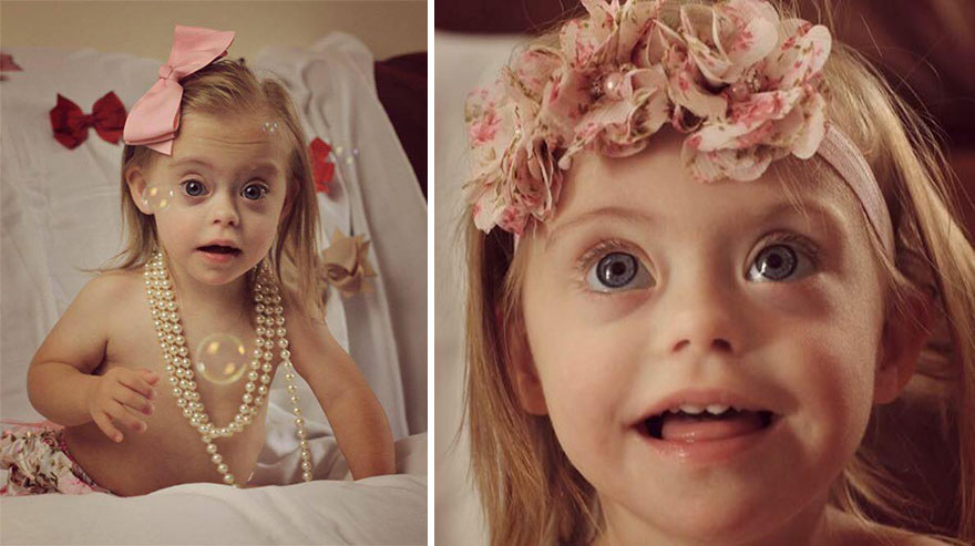 2-Year-Old Girl With Down Syndrome Wins Modeling Contract Thanks To Her Cheeky Smile 2-Year-Old Girl With Down Syndrome Wins Modeling Contract Thanks To Her Cheeky Smile