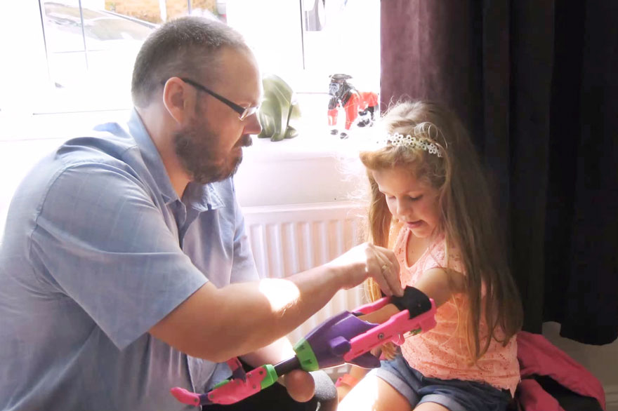 Girl Surprised To Receive 3D-Printed Arm From Designer Who Is Also Missing His Left Arm