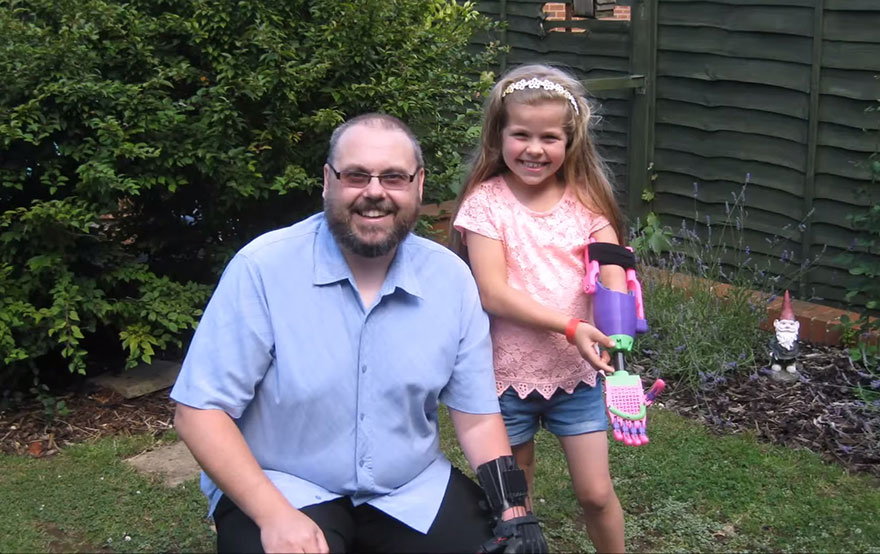 Girl Surprised To Receive 3D-Printed Arm From Designer Who Is Also Missing His Left Arm