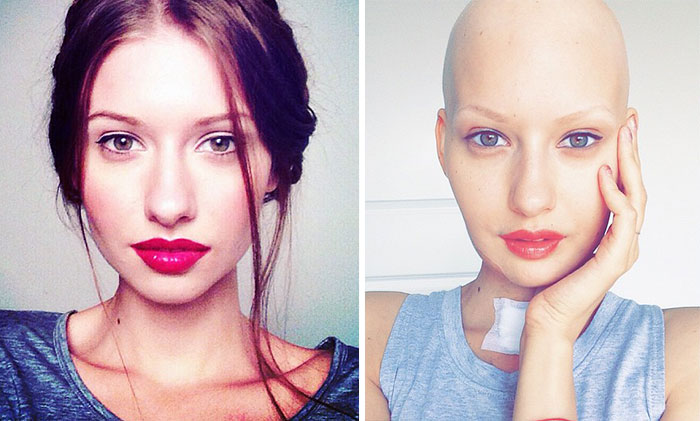 Doctors Told Model To Abort Her Child After She Lost 95% Of Her Jaw To Cancer. This Is What She Did Doctors Told Model To Abort Her Child After She Lost 95% Of Her Jaw To Cancer. This Is What She Did