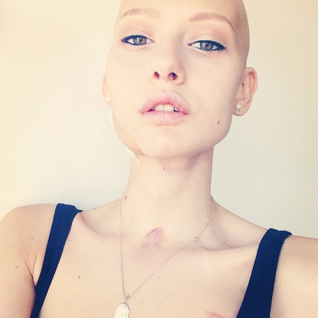 Doctors Told Model To Abort Her Child After She Lost 95% Of Her Jaw To Cancer. This Is What She Did Doctors Told Model To Abort Her Child After She Lost 95% Of Her Jaw To Cancer. This Is What She Did