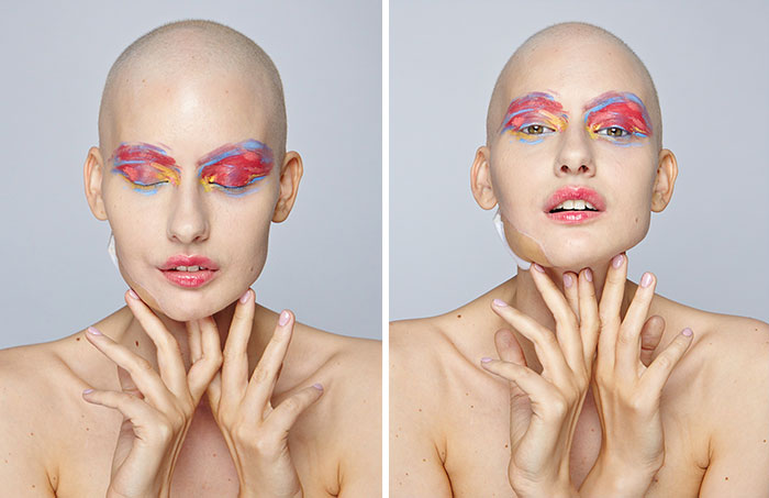 Doctors Told Model To Abort Her Child After She Lost 95% Of Her Jaw To Cancer. This Is What She Did Doctors Told Model To Abort Her Child After She Lost 95% Of Her Jaw To Cancer. This Is What She Did