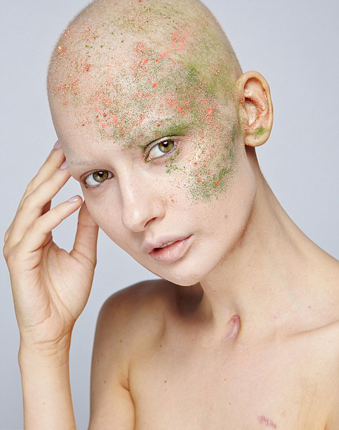 Doctors Told Model To Abort Her Child After She Lost 95% Of Her Jaw To Cancer. This Is What She Did Doctors Told Model To Abort Her Child After She Lost 95% Of Her Jaw To Cancer. This Is What She Did