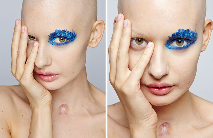 Doctors Told Model To Abort Her Child After She Lost 95% Of Her Jaw To Cancer. This Is What She Did Doctors Told Model To Abort Her Child After She Lost 95% Of Her Jaw To Cancer. This Is What She Did