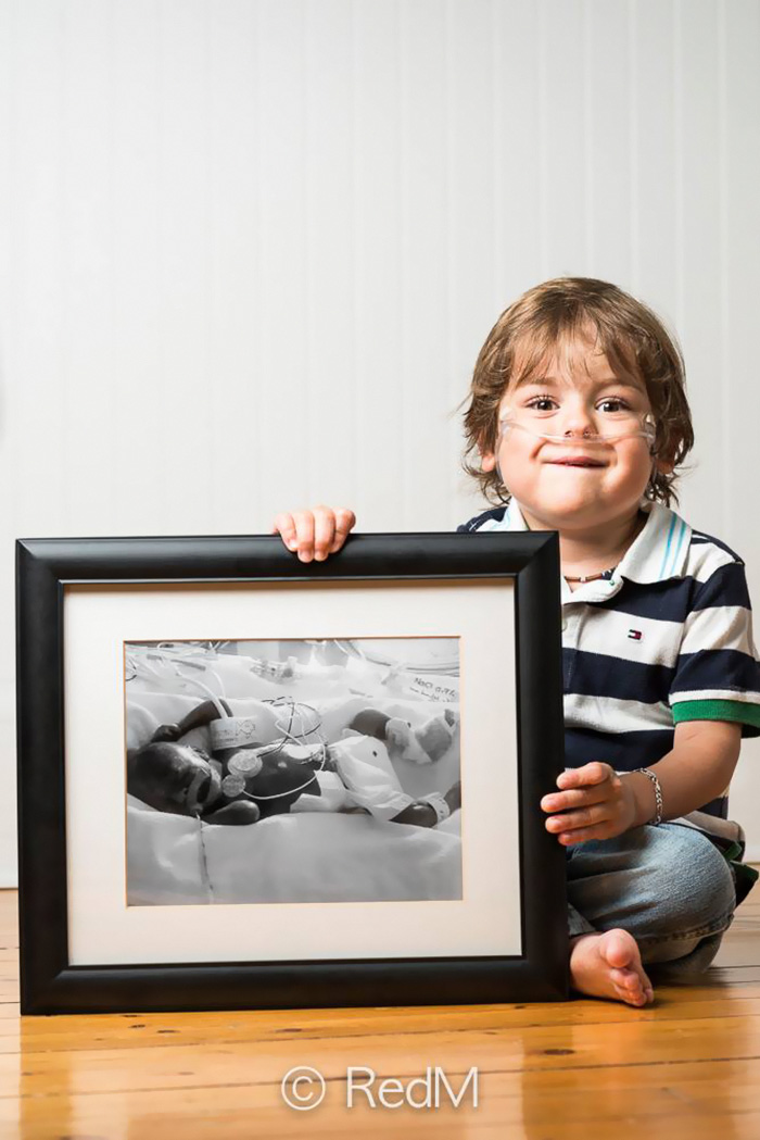 Powerful Before-And-After Portraits Of Premature Babies