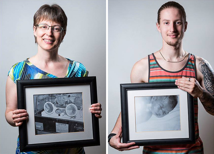 Powerful Before-And-After Portraits Of Premature Babies