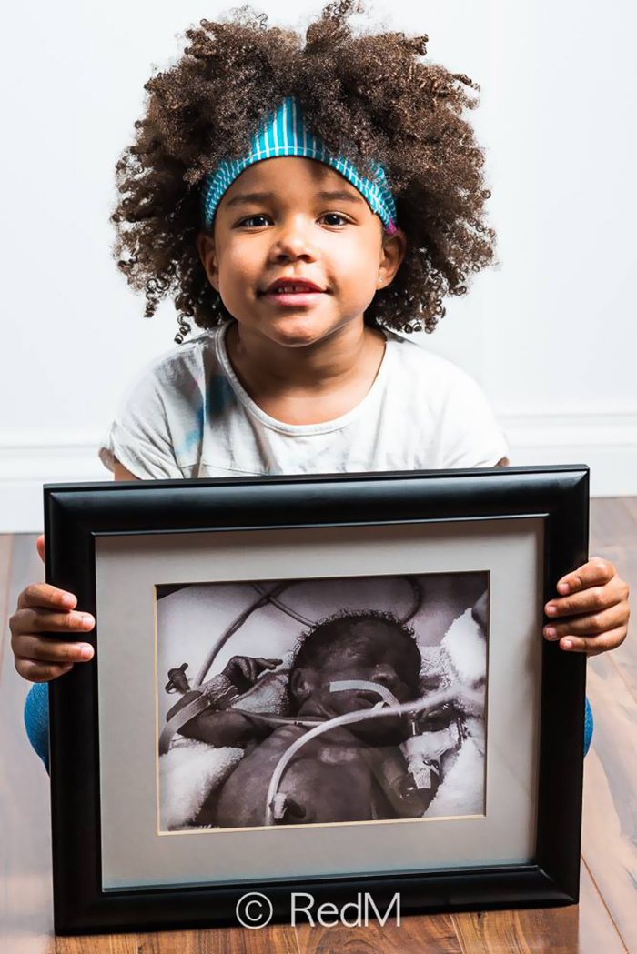 Powerful Before-And-After Portraits Of Premature Babies