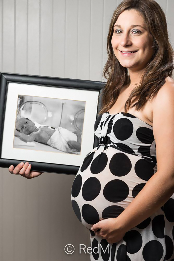 Powerful Before-And-After Portraits Of Premature Babies