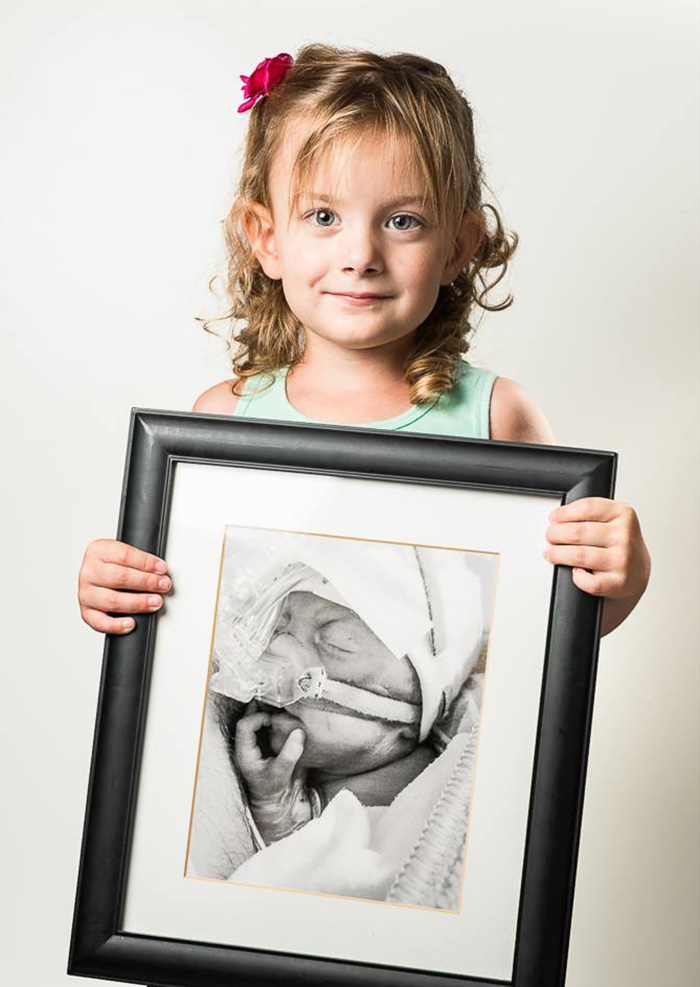 Powerful Before-And-After Portraits Of Premature Babies