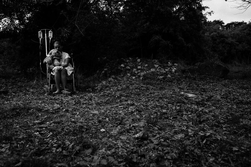 The Diary Of A Bald Girl In The Final Stage Of Cancer