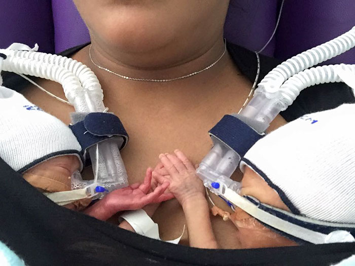 Premature Twins Holding Hands Take Internet By Storm