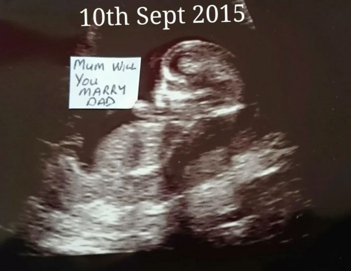 Guy Hides Marriage Proposal In Every Photo With His Girlfriend For Months Guy Hides Marriage Proposal In Every Photo With His Girlfriend For Months