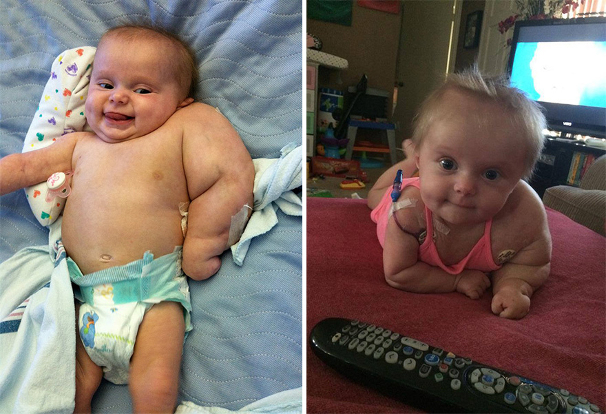 3-Legged Kitten Adopted By Amputee Girl Becomes Her Best Friend 3-Legged Kitten Adopted By Amputee Girl Becomes Her Best Friend