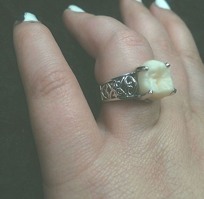 This Woman Got An Engagement Ring With Her Fiance&#8217;s Wisdom Tooth