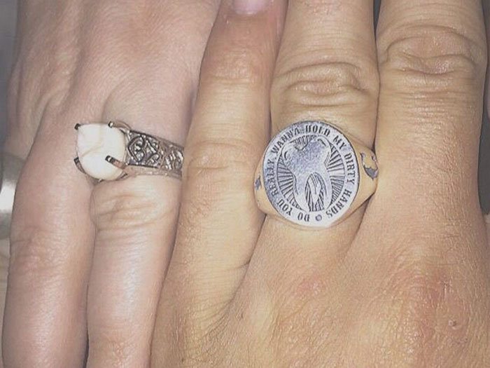 This Woman Got An Engagement Ring With Her Fiance&#8217;s Wisdom Tooth