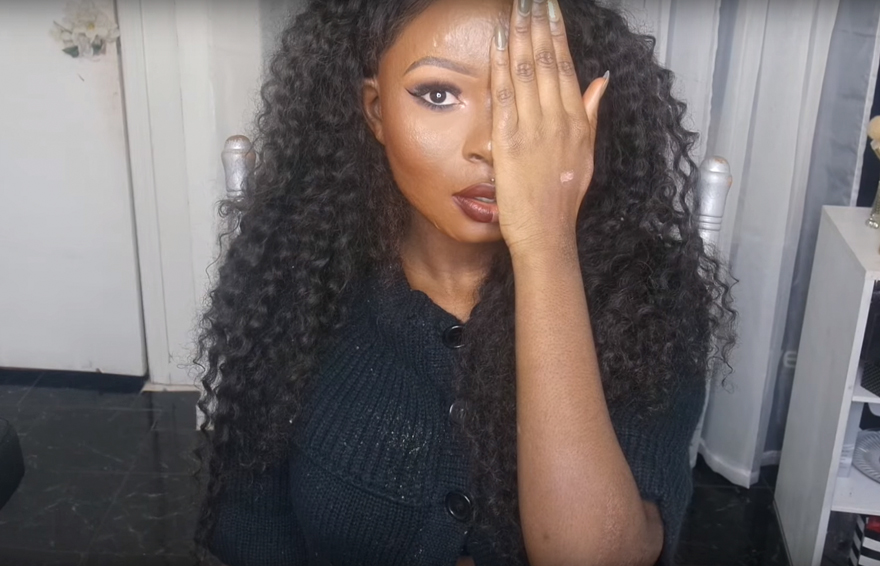 Burn Survivor Bullied At School Becomes Makeup Artist To Help Other Victims