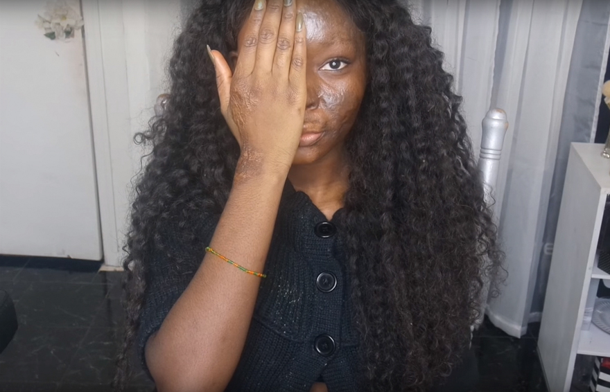 Burn Survivor Bullied At School Becomes Makeup Artist To Help Other Victims