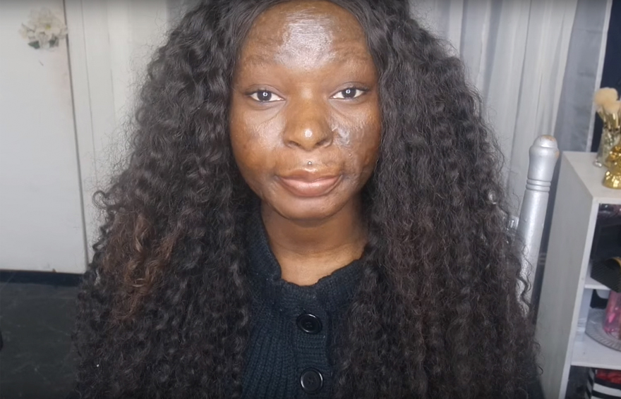 Burn Survivor Bullied At School Becomes Makeup Artist To Help Other Victims
