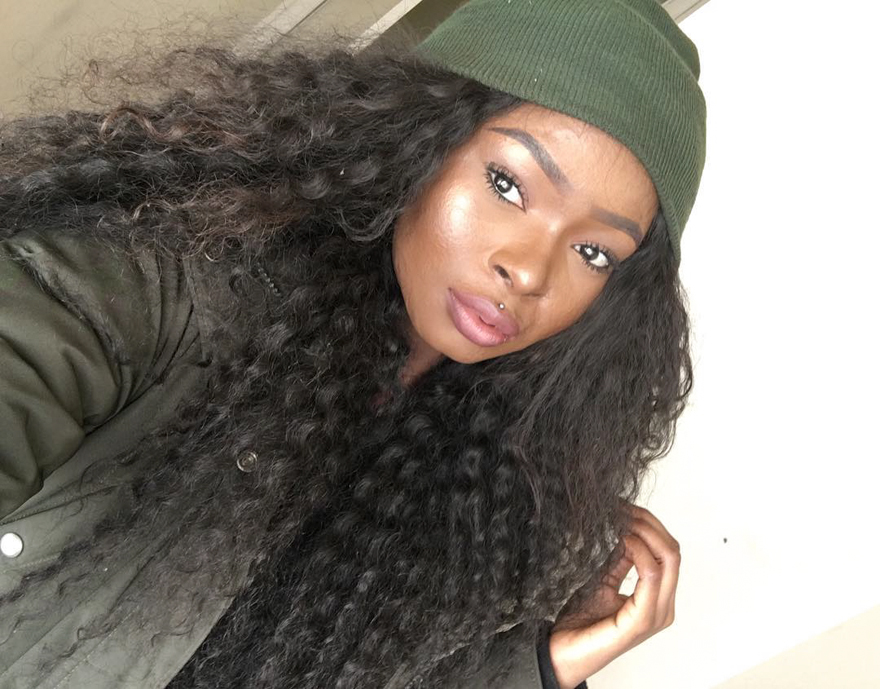 Burn Survivor Bullied At School Becomes Makeup Artist To Help Other Victims