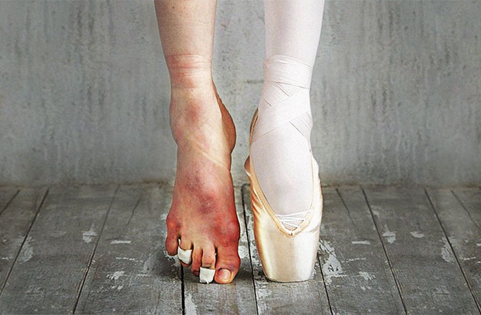The Cost Of Applause: 77 Pics To Celebrate Ballet Day