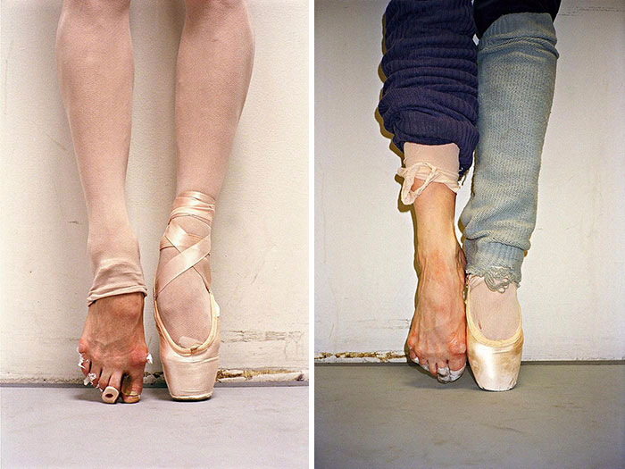 The Cost Of Applause: 77 Pics To Celebrate Ballet Day