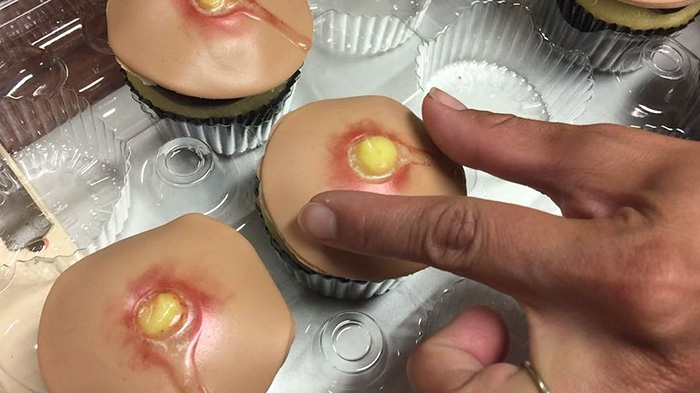Pimple Cupcakes With Squeezable Heads Are A Thing Now (Unfortunately) Pimple Cupcakes With Squeezable Heads Are A Thing Now (Unfortunately)
