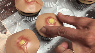 Pimple Cupcakes With Squeezable Heads Are A Thing Now (Unfortunately) Pimple Cupcakes With Squeezable Heads Are A Thing Now (Unfortunately)