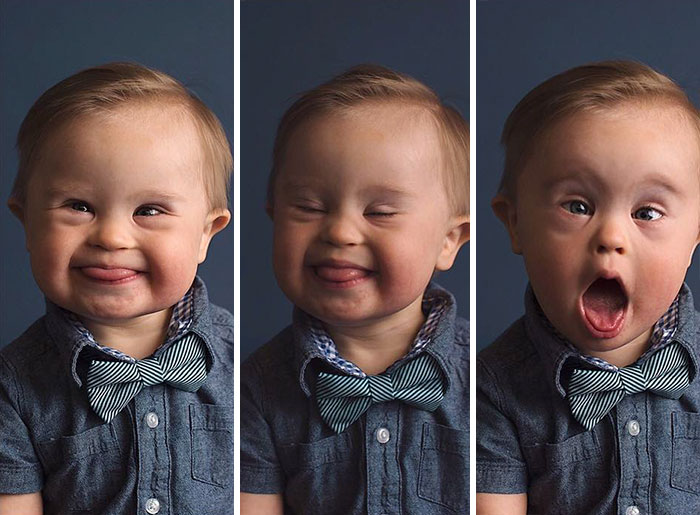 Kid Gets Rejected From Ad Campaign &#8220;Because He Has Down&#8217;s Syndrome&#8221;, Mom Fights Back