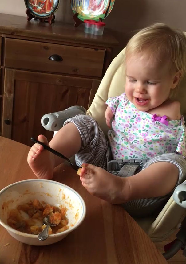 Toddler Born Without Arms Learns To Feed Herself Using Her Feet Toddler Born Without Arms Learns To Feed Herself Using Her Feet