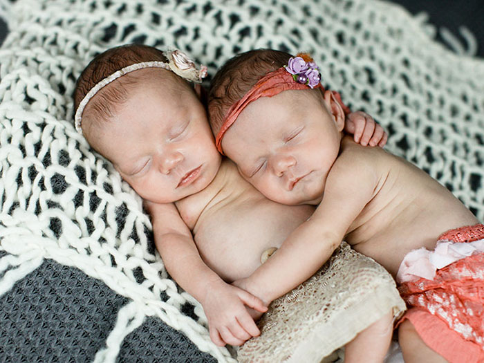 Twins Born Holding Hands 2 Years Ago Are Now Closer Than Ever