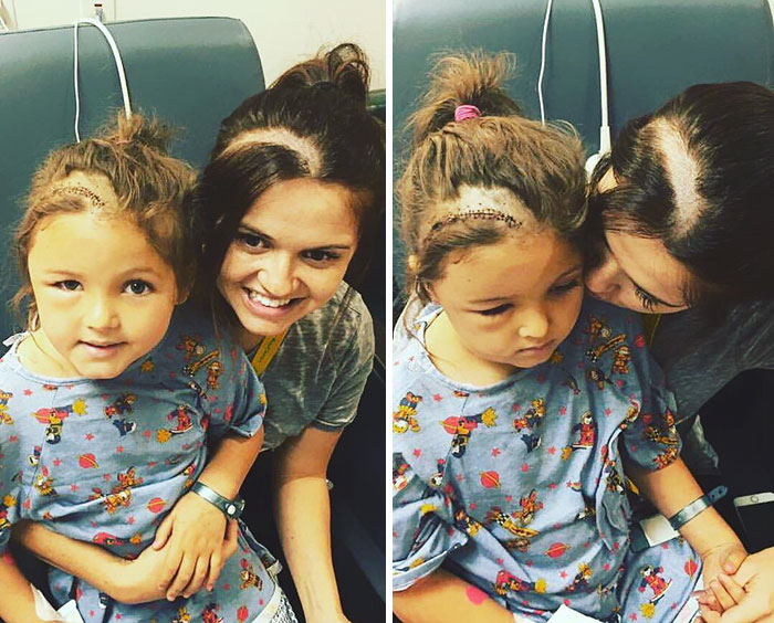 Mom Shaves Her Head So Her Daughter Wouldn&#8217;t Feel Different After Brain Surgery