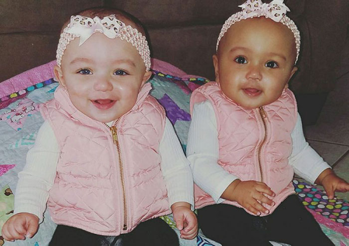 Super Rare Biracial Twins Born In Illinois, And “Nobody Believes They’re Twins” Super Rare Biracial Twins Born In Illinois, And “Nobody Believes They’re Twins”