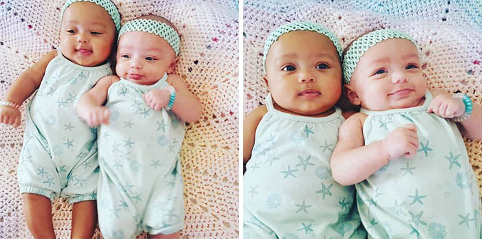 Super Rare Biracial Twins Born In Illinois, And “Nobody Believes They’re Twins” Super Rare Biracial Twins Born In Illinois, And “Nobody Believes They’re Twins”
