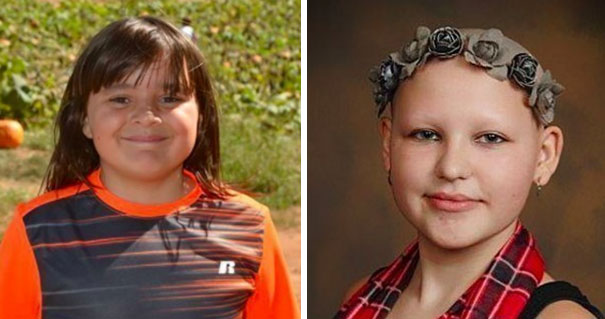 10-Year-Old Boy Grows Hair For 2 Years To Make Wig For Friend With Alopecia 10-Year-Old Boy Grows Hair For 2 Years To Make Wig For Friend With Alopecia