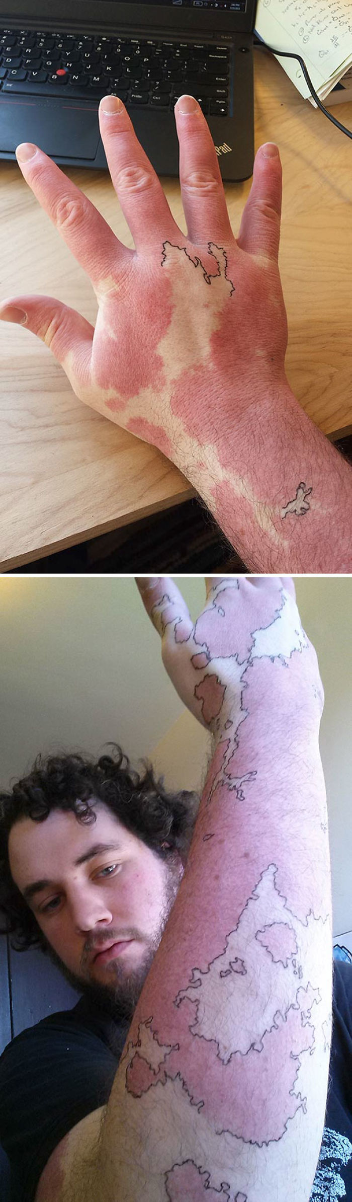 35 Genius Birthmark Cover-Up Tattoos 35 Genius Birthmark Cover-Up Tattoos