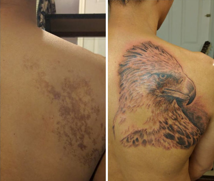 35 Genius Birthmark Cover-Up Tattoos 35 Genius Birthmark Cover-Up Tattoos