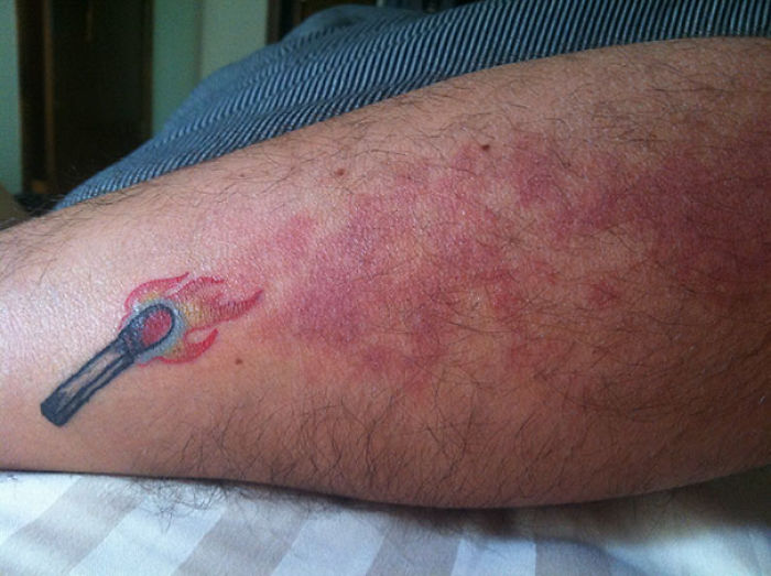 35 Genius Birthmark Cover-Up Tattoos 35 Genius Birthmark Cover-Up Tattoos