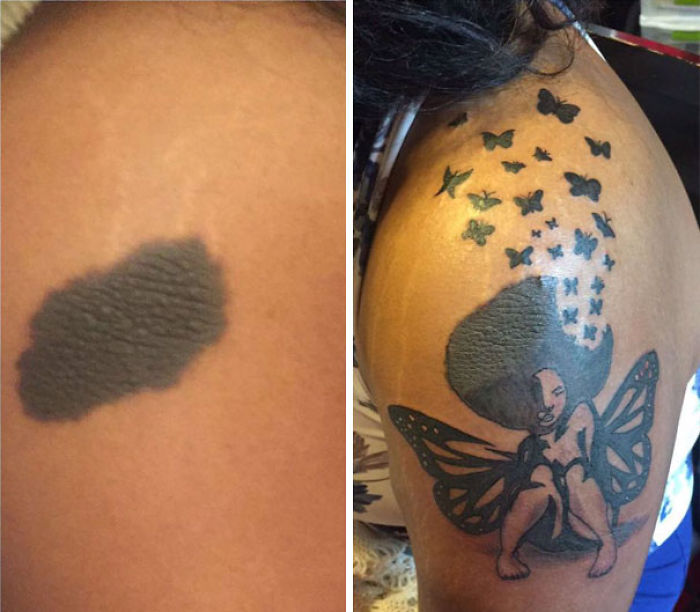 35 Genius Birthmark Cover-Up Tattoos 35 Genius Birthmark Cover-Up Tattoos