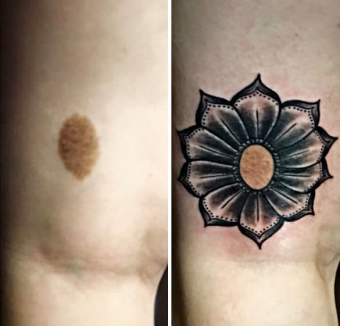 35 Genius Birthmark Cover-Up Tattoos 35 Genius Birthmark Cover-Up Tattoos