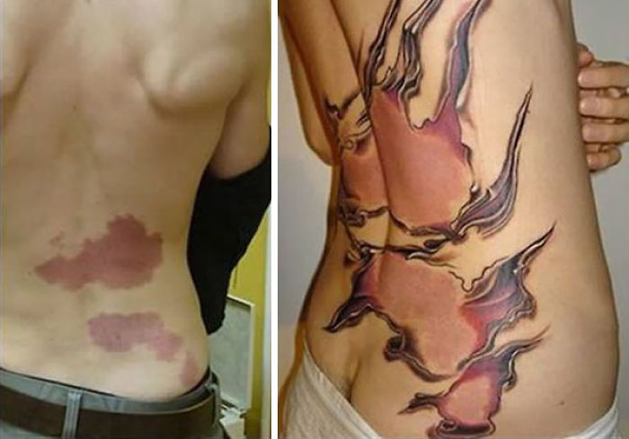 35 Genius Birthmark Cover-Up Tattoos 35 Genius Birthmark Cover-Up Tattoos