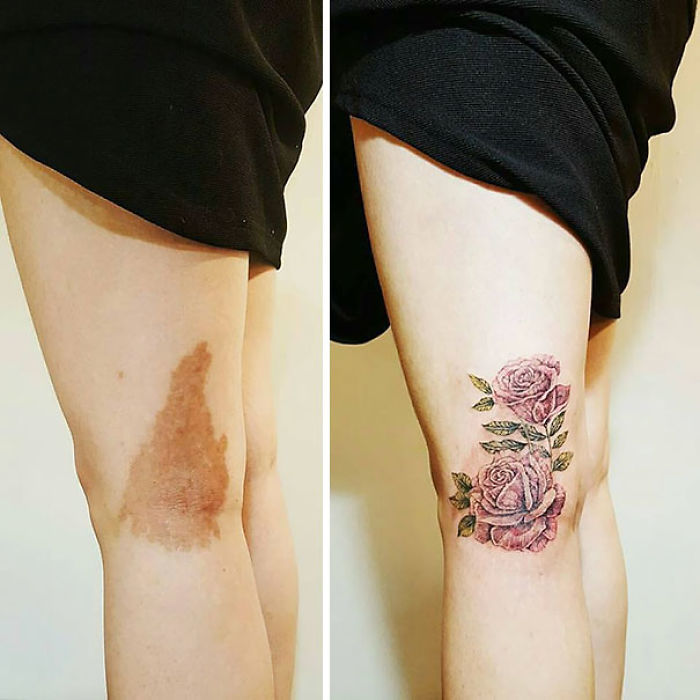 35 Genius Birthmark Cover-Up Tattoos 35 Genius Birthmark Cover-Up Tattoos
