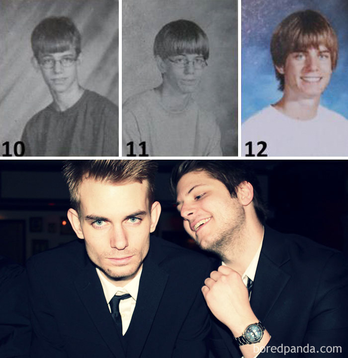 People Share Their Incredible “Ugly Duckling” Transformations And It’s Hard To Believe They’re The Same People People Share Their Incredible “Ugly Duckling” Transformations And It’s Hard To Believe They’re The Same People