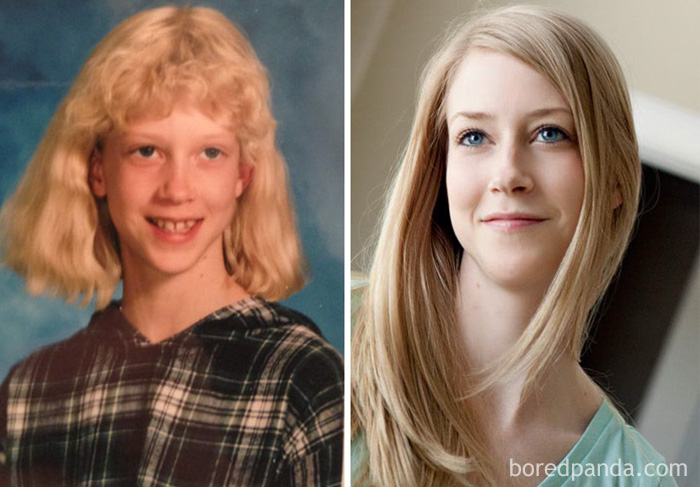 People Share Their Incredible “Ugly Duckling” Transformations And It’s Hard To Believe They’re The Same People People Share Their Incredible “Ugly Duckling” Transformations And It’s Hard To Believe They’re The Same People
