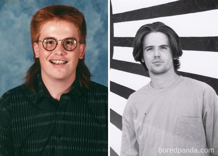 People Share Their Incredible “Ugly Duckling” Transformations And It’s Hard To Believe They’re The Same People People Share Their Incredible “Ugly Duckling” Transformations And It’s Hard To Believe They’re The Same People