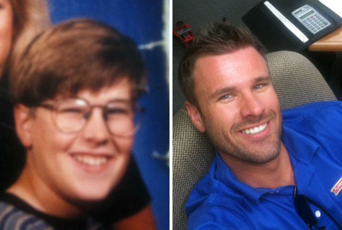 People Share Their Incredible “Ugly Duckling” Transformations And It’s Hard To Believe They’re The Same People People Share Their Incredible “Ugly Duckling” Transformations And It’s Hard To Believe They’re The Same People